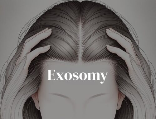 Exosomy